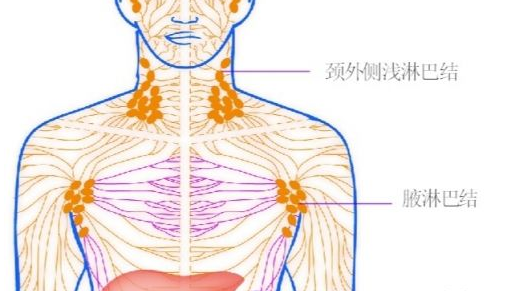 恶心淋巴瘤的早期症状是哪些
