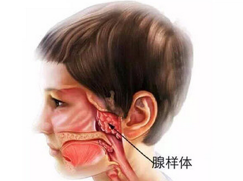 腺样体 平安保险小孩腺样体